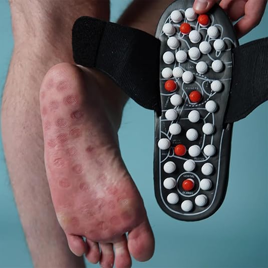 Ictonic™ Acupressure Sandals